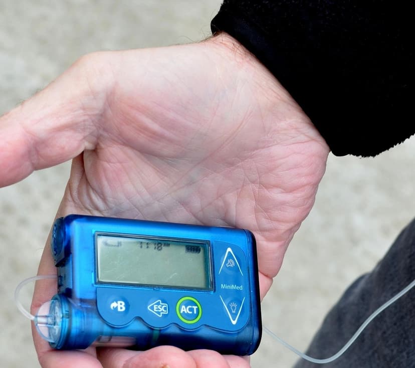 HbA1c uitgelegd: wat zijn gezonde waarden? - diabetes artikel